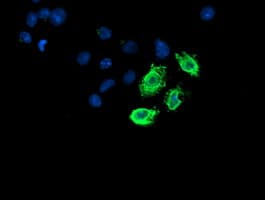 LPL / Lipoprotein Lipase Antibody (clone OTI5C6)