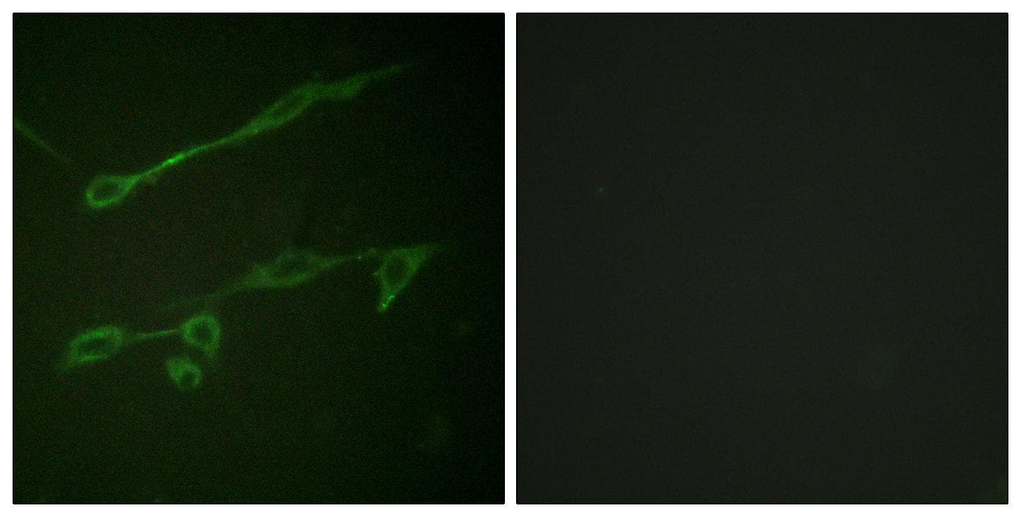 VAV2 Antibody (phospho-Tyr142)