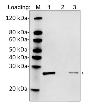 Monoclonal Rabbit His Tag Antibody (clone 25B6E11, IF, WB)