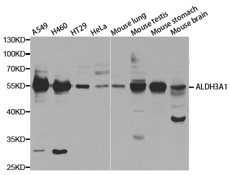 Polyclonal Rabbit anti-Human ALDH3A1 Antibody (IHC, IF, WB)