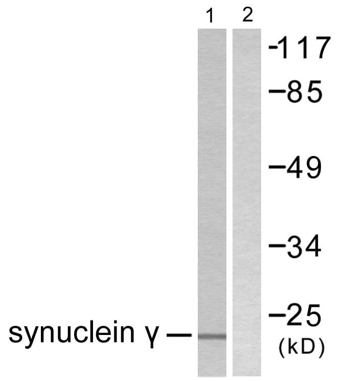SNCG / Gamma-Synuclein Antibody