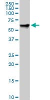 Monoclonal Mouse anti-Human RDX / Radixin Antibody (clone 1E12, IF, WB)