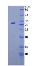 Human ANGPTL2 / ARP2 Protein (Recombinant His)