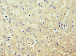 AKR7A3 Antibody (aa1-331)