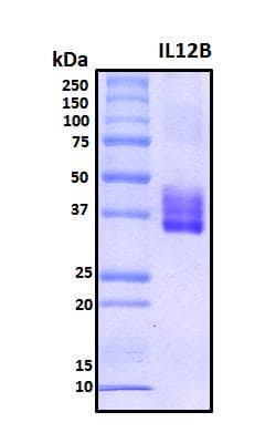 Human IL12B / IL12 p40 Protein (Recombinant His, N-Terminal)