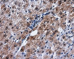 PME-1 / PPME1 Antibody (clone OTI4A12)