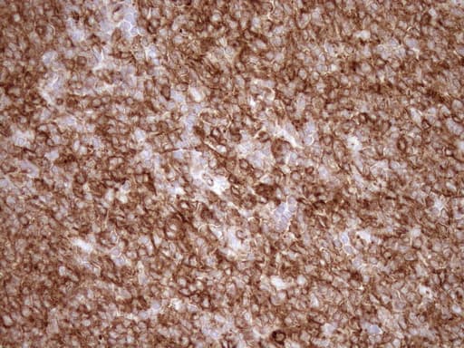 Monoclonal Mouse anti-Human EPLIN Antibody (clone OTI9F3, aa1-275, IHC, WB)