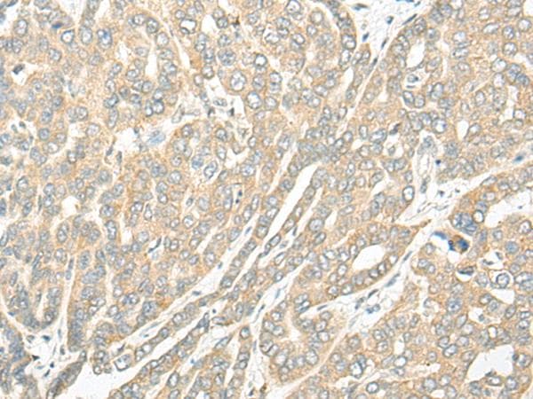ROM1 Antibody