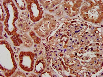 PIGV Antibody