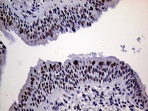 ERCC3 / XPB Antibody (aa191-436, clone OTI6H8)