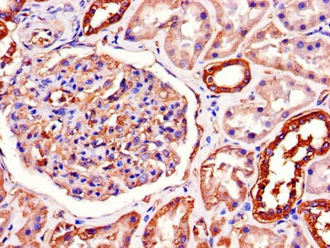 Polyclonal Rabbit anti-Human ATP1A1 Antibody (IHC, IF)