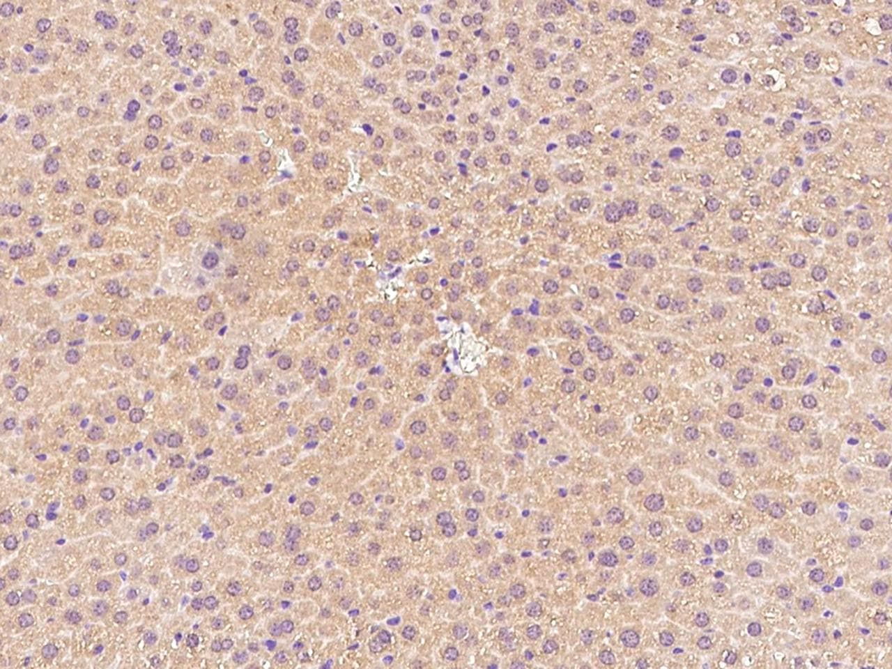 CPT2 Antibody (Preservative Free)