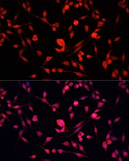 YBX1 / YB1 Antibody