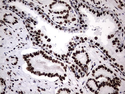 HNRPM / HNRNPM Antibody (aa1-261, clone OTI4C9)