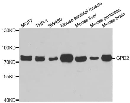 IHC-plus™ Polyclonal Rabbit anti-Human GPD2 Antibody (IHC, WB)