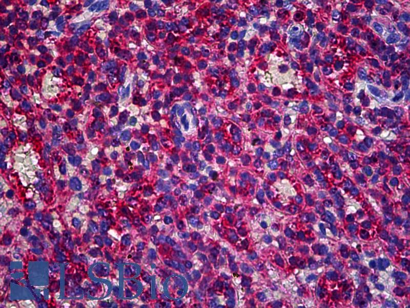 IHC-plus™ CAPZB / CAPZ Beta Antibody (clone 1H1)