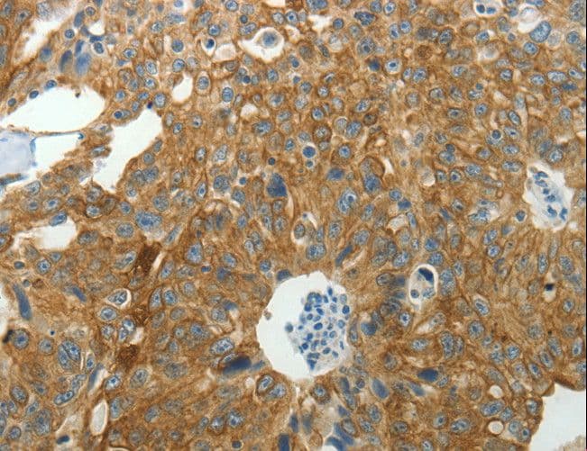 NDRG2 Antibody