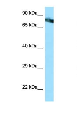 Polyclonal Rabbit anti-Human MCAM / CD146 Antibody (aa289-338, IHC, WB)