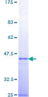 Human TSG101 Protein (Recombinant GST, N-terminus)