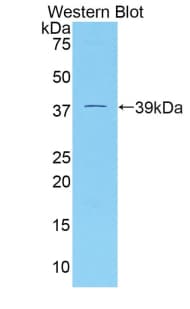 DKK4 Antibody (aa37-141)