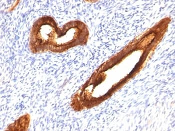 EMA / MUC1 Antibody (clone MUC1/955)