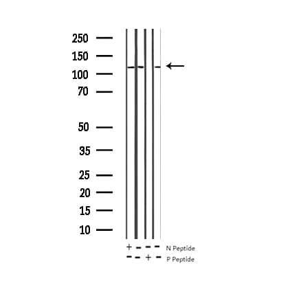 APP / Beta Amyloid Precursor Antibody (phospho-Thr743,pThr668)