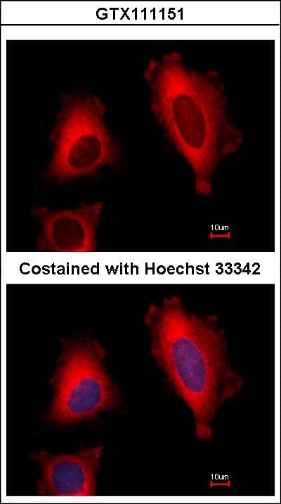 EEF1D Antibody