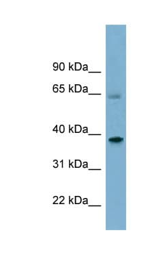 Polyclonal Rabbit anti-Human SNX7 Antibody (aa359-408, WB)