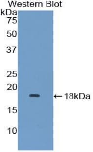 LAMTOR3 / MP1 Antibody (aa1-124)