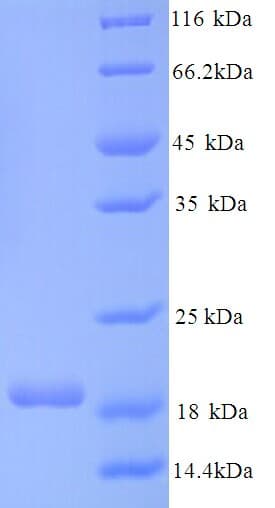 Human CNKSR2 Protein (Recombinant His)