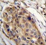 Polyclonal Rabbit anti-Human SSH3 Antibody (aa575-602, IHC, IF, WB)