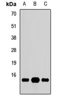 Polyclonal Rabbit anti-Human GNG10 Antibody (WB)
