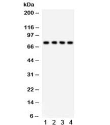 Polyclonal Rabbit anti-Human TNFRSF1B / TNFR2 Antibody (WB)