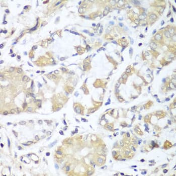 RPH3AL Antibody