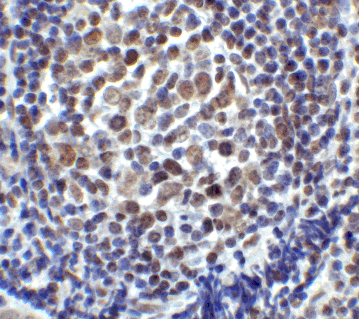 Polyclonal Rabbit anti-Human LAG3 Antibody (IHC, IF, WB)