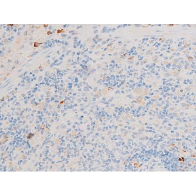 GATA4 Antibody (phospho-Ser105)