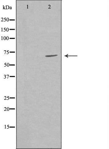 GRK6 Antibody