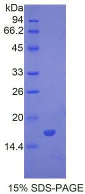 Mouse BMP7 Protein (Recombinant His)