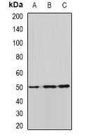 Polyclonal Rabbit anti-Human ALDH9A1 Antibody (WB)