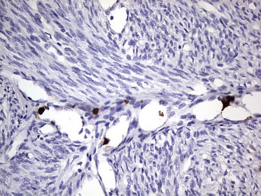 Monoclonal Mouse anti-Human CEACAM5 / CD66e Antibody (clone OTI3D8, aa35-680, IHC, WB)
