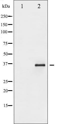 Polyclonal Rabbit anti-Human NFKBIE / IKB Epsilon Antibody (phospho-Ser22, IHC, IF, WB)