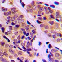 Polyclonal Rabbit anti-Human MAP3K5 / ASK1 Antibody (Internal, IHC, WB)