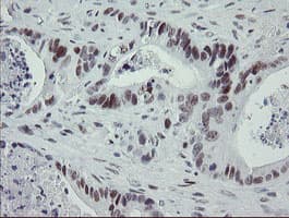 TLE1 / TLE 1 Antibody (aa180-460, clone OTI1F9)