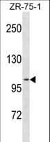 Polyclonal Rabbit anti-Human PR / Progesterone Receptor Antibody (aa833-861, WB)