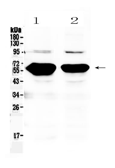 Polyclonal Rabbit anti-Human AMY1A + AMY1B + AMY1 Antibody (IHC, WB)