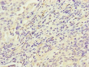 HK3 / Hexokinase 3 Antibody