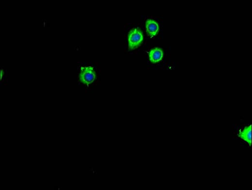 Polyclonal Rabbit anti-Human RPL26 / Ribosomal Protein L26 Antibody (IF)