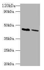 KCNJ1 / ROMK Antibody