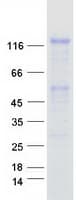 Human FGFR1 / FGF Receptor 1 Protein (Recombinant Myc-DDK (Flag))
