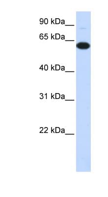 Polyclonal Rabbit anti-Human FBXO24 Antibody (C-Terminus, WB)